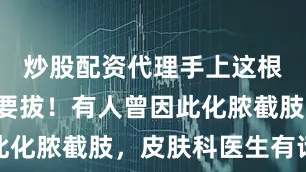 炒股配资代理手上这根“刺”不要拔！有人曾因此化脓截肢，皮肤科医生有话说
